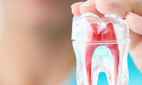 Возможно ли удаление кисты с сохранением зуба?
